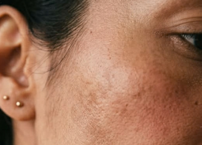 Dull & uneven-looking skin