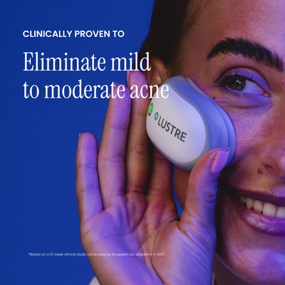 Lustre SOLO: Blue Light Therapy for Acne