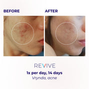 LUSTRE REVIVE LED Mask | US
