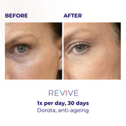 LUSTRE REVIVE LED Mask | US