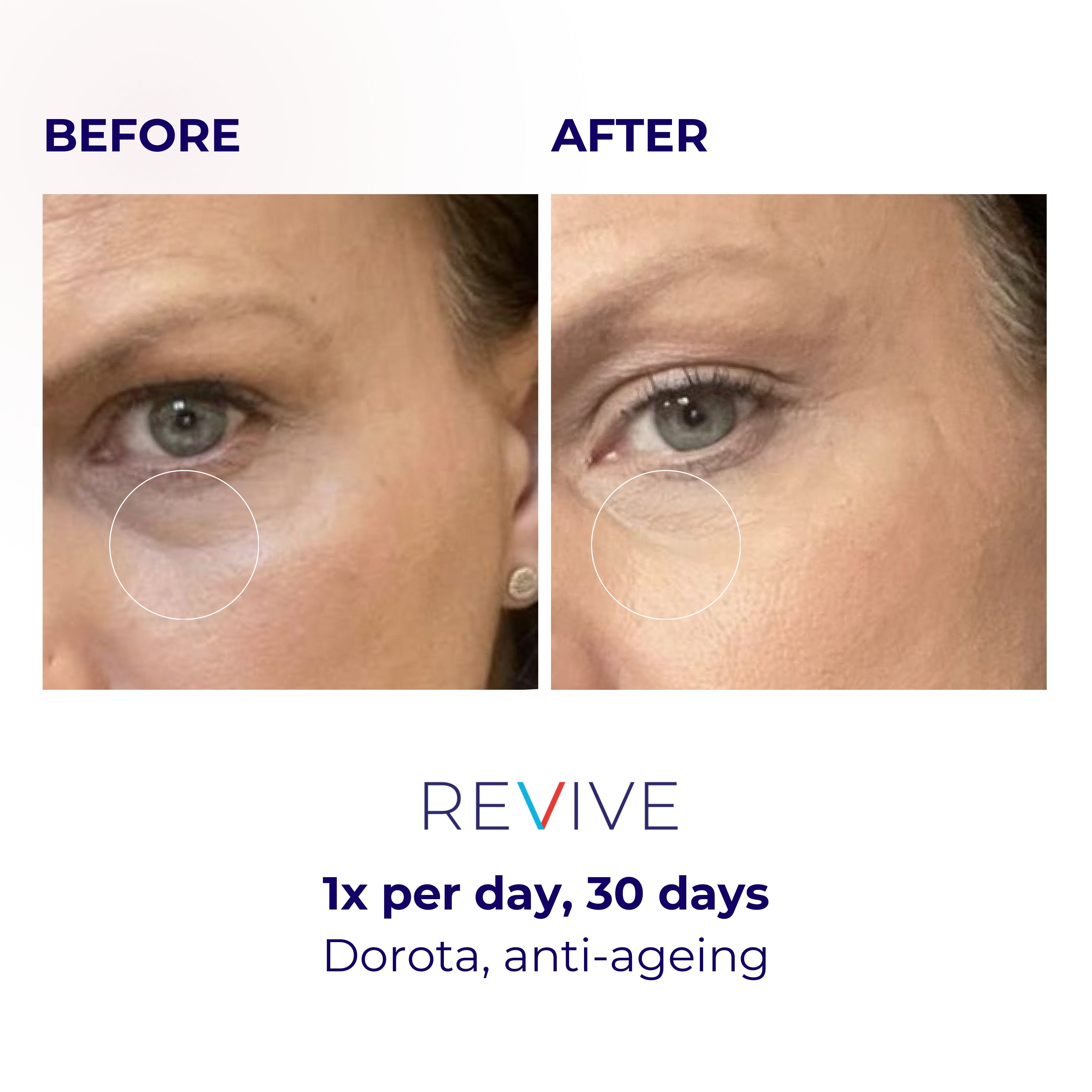 LUSTRE REVIVE LED Mask | US