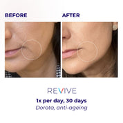 LUSTRE REVIVE LED Mask | US