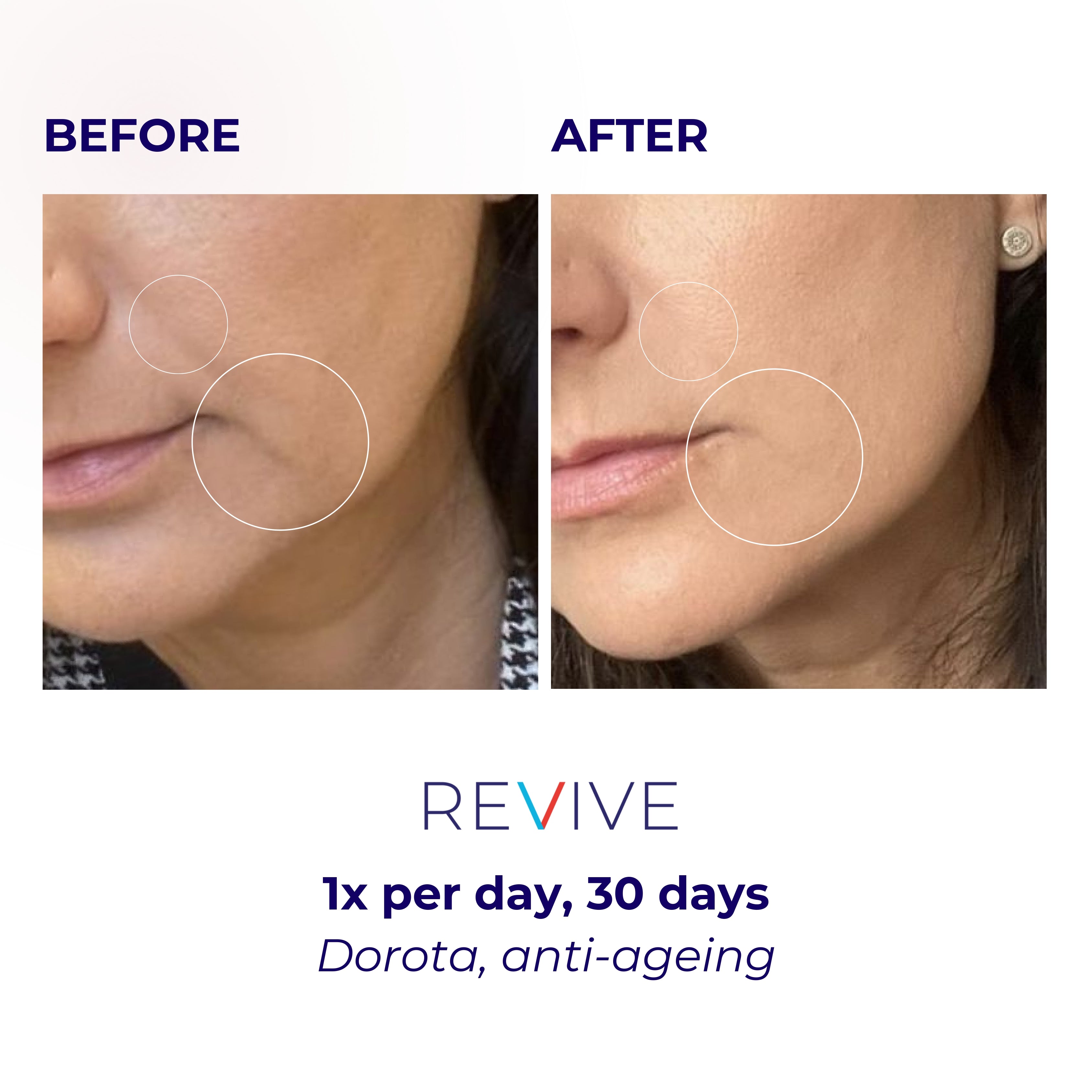 LUSTRE REVIVE LED Mask | US