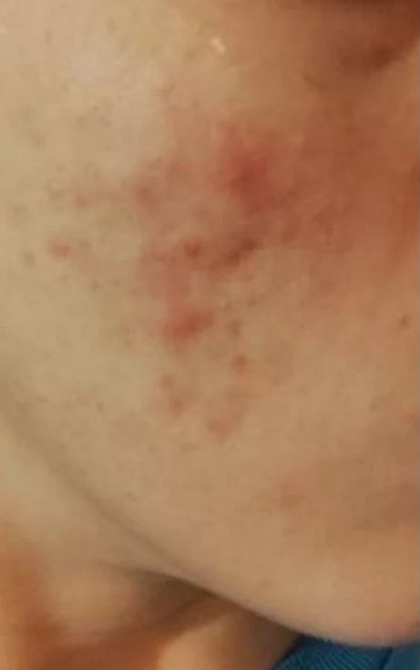 Day 1