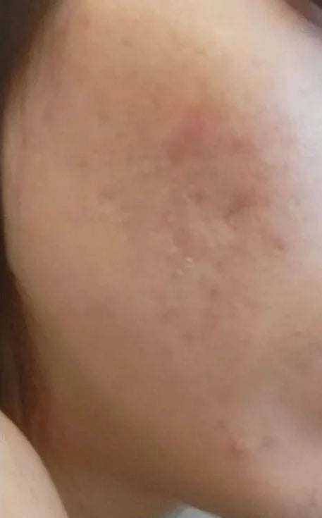 Day 7